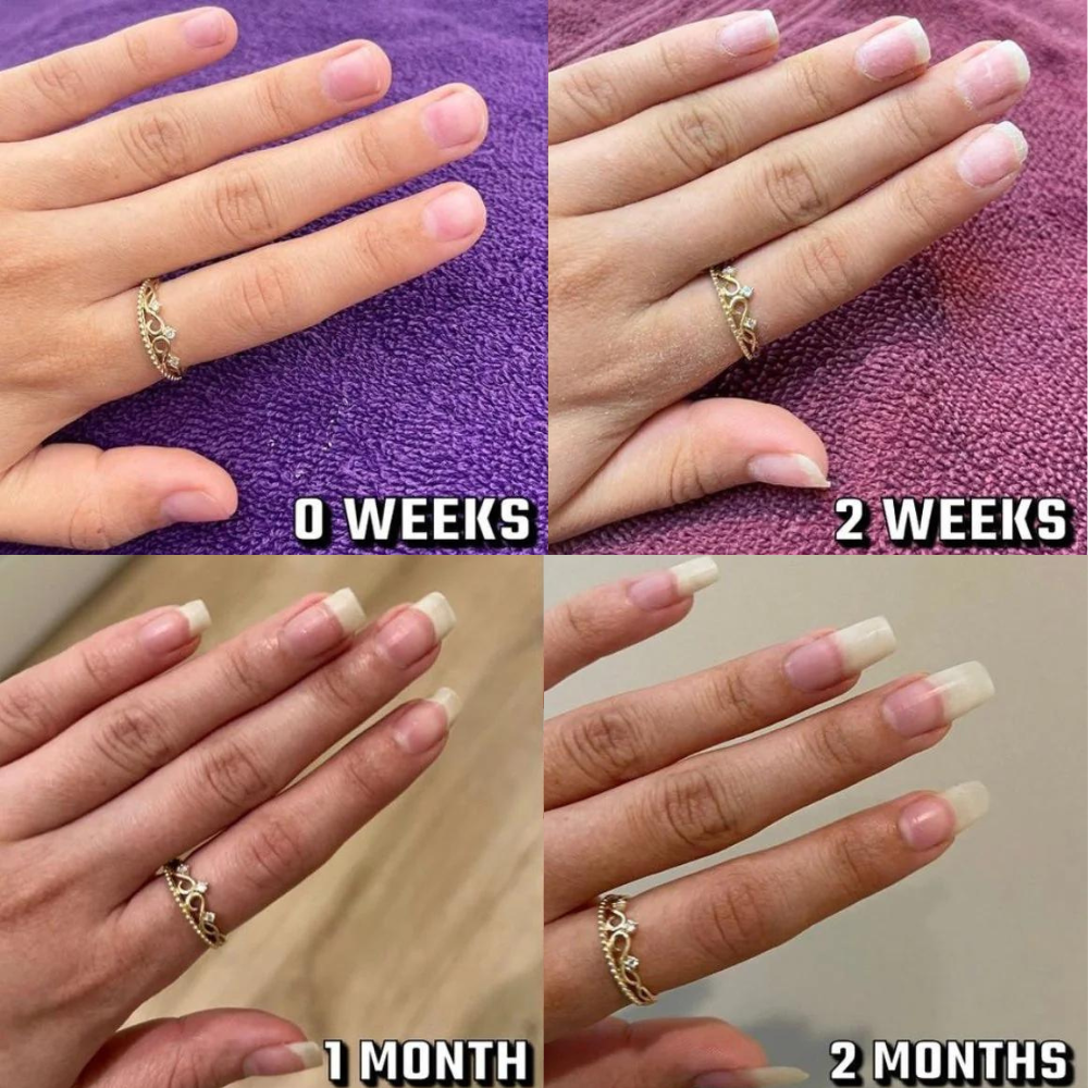 قلم زيت غلوورا لنمو الأظافر | تركيبة مقوّية ومغذية | للأظافر الضعيفة والهشة وبطيئة النمو | علاج للعناية بالبشرة | نمو سريع وتقليل التكسر