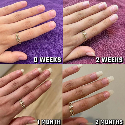 قلم زيت غلوورا لنمو الأظافر | تركيبة مقوّية ومغذية | للأظافر الضعيفة والهشة وبطيئة النمو | علاج للعناية بالبشرة | نمو سريع وتقليل التكسر