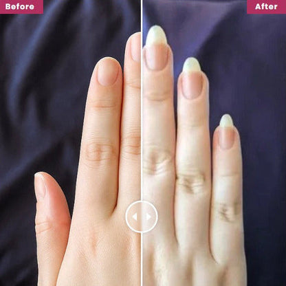 قلم زيت غلوورا لنمو الأظافر | تركيبة مقوّية ومغذية | للأظافر الضعيفة والهشة وبطيئة النمو | علاج للعناية بالبشرة | نمو سريع وتقليل التكسر