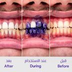 سيروم Hismile V34 لتصحيح لون الأسنان وتبييضها